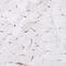 Lysosomal Associated Membrane Protein 1 antibody, AMAb91299, Atlas Antibodies, Immunohistochemistry frozen image 