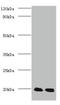 Parkinsonism Associated Deglycase antibody, A53957-100, Epigentek, Western Blot image 