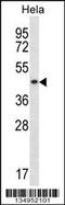 DnaJ Heat Shock Protein Family (Hsp40) Member A3 antibody, 57-960, ProSci, Western Blot image 