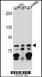 Zinc Finger Protein 555 antibody, 56-942, ProSci, Western Blot image 