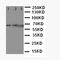Interleukin 23 Subunit Alpha antibody, LS-C312628, Lifespan Biosciences, Western Blot image 