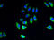 Phosphatidylinositol Glycan Anchor Biosynthesis Class O antibody, A60266-100, Epigentek, Immunofluorescence image 