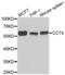 Chaperonin Containing TCP1 Subunit 4 antibody, abx005026, Abbexa, Western Blot image 