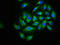 Calcium Voltage-Gated Channel Auxiliary Subunit Beta 2 antibody, LS-C670030, Lifespan Biosciences, Immunofluorescence image 