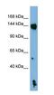 NLR Family Pyrin Domain Containing 1 antibody, GTX01082, GeneTex, Western Blot image 