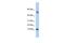 Myotrophin antibody, GTX45682, GeneTex, Western Blot image 