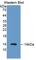 S100 Calcium Binding Protein A12 antibody, abx129972, Abbexa, Western Blot image 