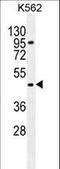 Carboxypeptidase A3 antibody, LS-C166983, Lifespan Biosciences, Western Blot image 