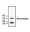 Cytochrome P450 Family 19 Subfamily A Member 1 antibody, PA1-21398, Invitrogen Antibodies, Western Blot image 