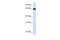 Leucine Rich Repeat Containing 4C antibody, A09626, Boster Biological Technology, Western Blot image 