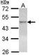 Nuclear Receptor Subfamily 1 Group H Member 2 antibody, GTX113571, GeneTex, Western Blot image 