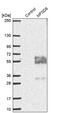 Major Facilitator Superfamily Domain Containing 8 antibody, PA5-60832, Invitrogen Antibodies, Western Blot image 