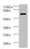 FAS antibody, A53081-100, Epigentek, Western Blot image 