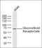 Glycerol Kinase 2 antibody, orb157150, Biorbyt, Western Blot image 