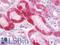Endoplasmic Reticulum Aminopeptidase 2 antibody, LS-B10127, Lifespan Biosciences, Immunohistochemistry paraffin image 