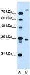 TMEM231 antibody, TA335940, Origene, Western Blot image 