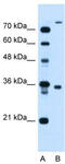 TMEM231 antibody, TA335940, Origene, Western Blot image 