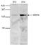 SET Domain Containing 1B, Histone Lysine Methyltransferase antibody, TA347285, Origene, Western Blot image 