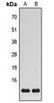 Mitochondrial Ribosomal Protein S21 antibody, LS-C368423, Lifespan Biosciences, Western Blot image 