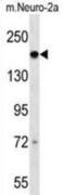 DCC Netrin 1 Receptor antibody, abx030863, Abbexa, Western Blot image 