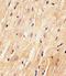 Mediator Complex Subunit 15 antibody, M03568-1, Boster Biological Technology, Immunohistochemistry paraffin image 