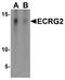 Serine Peptidase Inhibitor, Kazal Type 7 (Putative) antibody, A11563, Boster Biological Technology, Western Blot image 