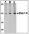 Cytokine receptor-like factor 2 antibody, LS-B3211, Lifespan Biosciences, Western Blot image 