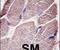 Protein Tyrosine Phosphatase Non-Receptor Type 21 antibody, PA5-15526, Invitrogen Antibodies, Immunohistochemistry paraffin image 