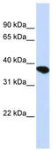 ST8 Alpha-N-Acetyl-Neuraminide Alpha-2,8-Sialyltransferase 4 antibody, TA346743, Origene, Western Blot image 