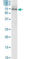 Secretin Receptor antibody, H00006344-M01, Novus Biologicals, Western Blot image 