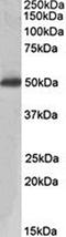 Acid Phosphatase, Prostate antibody, orb20559, Biorbyt, Western Blot image 