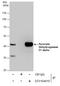 Pyruvate Dehydrogenase E1 Alpha 1 Subunit antibody, GTX104015, GeneTex, Immunoprecipitation image 