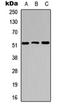 Angiogenin antibody, orb234756, Biorbyt, Western Blot image 