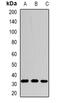 Spermidine Synthase antibody, abx142053, Abbexa, Western Blot image 