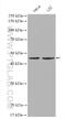 Serpin Family B Member 3 antibody, 26558-1-AP, Proteintech Group, Western Blot image 