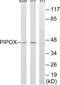 Pipecolic Acid And Sarcosine Oxidase antibody, GTX87135, GeneTex, Western Blot image 