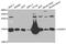 Cellular Retinoic Acid Binding Protein 2 antibody, orb247274, Biorbyt, Western Blot image 
