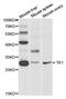 Thymidine Kinase 1 antibody, A5612, ABclonal Technology, Western Blot image 