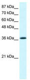 Kruppel Like Factor 1 antibody, TA331179, Origene, Western Blot image 