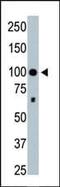 Histone Deacetylase 4 antibody, PA5-11236, Invitrogen Antibodies, Western Blot image 