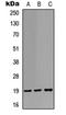 Stathmin 1 antibody, orb304613, Biorbyt, Western Blot image 