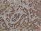 Heat Shock Protein Family A (Hsp70) Member 5 antibody, GTX33998, GeneTex, Immunohistochemistry paraffin image 