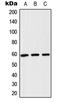 Chaperonin Containing TCP1 Subunit 8 antibody, LS-C353282, Lifespan Biosciences, Western Blot image 