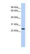 T-cell surface glycoprotein YE1/48 antibody, NBP1-59032, Novus Biologicals, Western Blot image 