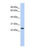 Ly-49a antibody, NBP1-59032, Novus Biologicals, Western Blot image 