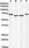 Acetylcholinesterase antibody, NB100-1519, Novus Biologicals, Western Blot image 