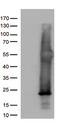Histone chaperone ASF1B antibody, M05211, Boster Biological Technology, Western Blot image 