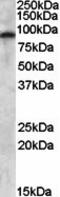 Glutamate receptor 4 antibody, orb88992, Biorbyt, Western Blot image 