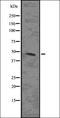 MAPK Activated Protein Kinase 2 antibody, orb336706, Biorbyt, Western Blot image 