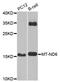 Malonyl-CoA-Acyl Carrier Protein Transacylase antibody, STJ113678, St John